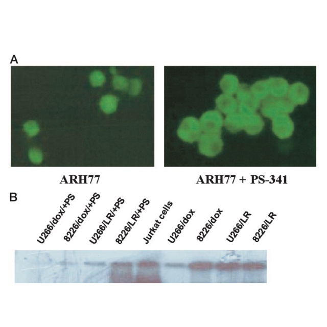 Figure showing PS-341-mediated changes in NF-kappa-B localization and DNA-binding activity in multiple myeloma cells.